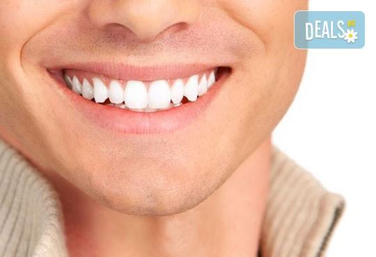 Кабинетно избелване на зъби с Pure Whitening System в ПримаДент