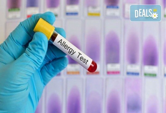 Комбиниран тест за алергии с изследване на 295 алергена в СМДЛ