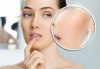 Мануално почистване на лице, маска според типа кожа, козметичен масаж, дарсонвал и нанасяне на крем в Senses Massage & Recreation! - thumb 2