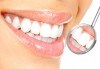 За красива и здрава усмивка! Почистване на зъбен камък и полиране в Дентален кабинет Марица 11 - thumb 3
