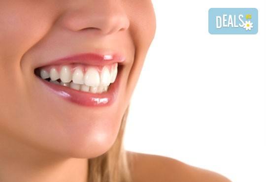 Широка усмивка! Пакет Профилактика и лечение на парадонтит в стоматологична клиника д-р Георгиев - Снимка 2
