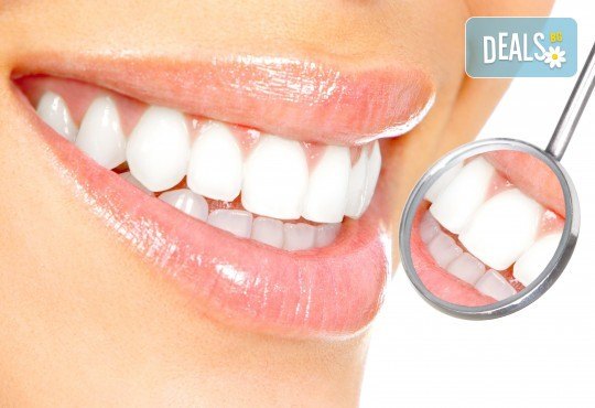 Избелване на зъби с иновативната система PURE на фирма Axis, почистване на зъбен камък и обстоен стоматологичен преглед от д-р Диляна Кънчева - Снимка 3