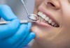 Широка усмивка! Пакет Профилактика и лечение на парадонтит в стоматологична клиника д-р Георгиев - thumb 1
