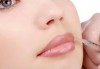Уголемяване на устни с 1мл хиалуронов филър извършено от лекар-специалист в Медицински център за медико-естетични процедури! - thumb 4