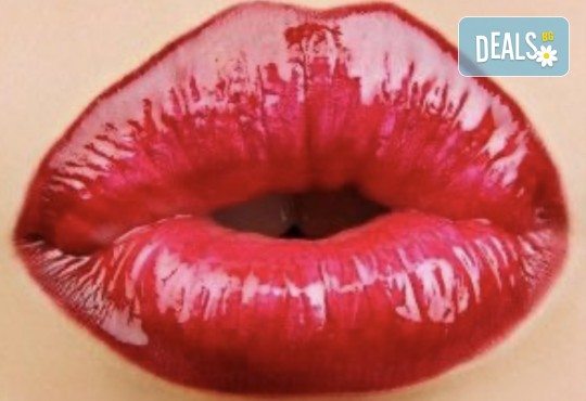 Уголемяване на устни с 1мл хиалуронов филър извършено от лекар-специалист в Медицински център за медико-естетични процедури! - Снимка 1