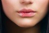 За чувствени устни! Безиглена мезотерапия за подобряване естествения обем на устните с хиалуронов мезококтейл от Morea Beauty Studio - thumb 1