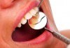 Ултразвуково почистване на зъбен камък и премахване на петна с Airflow, плюс полиране и преглед от Стоматологичен кабинет Финеса Дентале - thumb 1