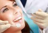 Ултразвуково почистване на зъбен камък и премахване на петна с Airflow, плюс полиране и преглед от Стоматологичен кабинет Финеса Дентале - thumb 2