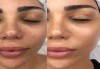 Озаряване и освежаване на кожата с ултразвукова терапия! Прилагане на тонер и серум, хидратация за успокояване на кожата в Makeup & Beauty Private Studio - thumb 3