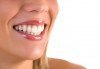 Кабинетно избелване на зъби с Pure Whitening System, почистване на зъбен камък, полиране и преглед в ПримаДент - д-р Анита Ангелова - thumb 2
