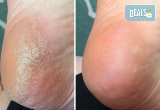 Нежни ходила с пролетно настроение! Поглезете крачетата си със SPA педикюр с гел лак в Салон за красота Beauty Angels - Снимка 7