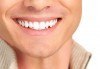 Кабинетно избелване на зъби с швейцарската система Pure Whitening System, почистване на зъбен камък, полиране и преглед в ПримаДент - д-р Анита Ангелова - thumb 1