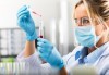 Изследване за антитела срещу СПИН (Аnti - HIV тест) в СМДЛ Кандиларов - thumb 1