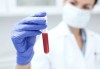 Изследване за антитела срещу СПИН (Аnti - HIV тест) в СМДЛ Кандиларов - thumb 2