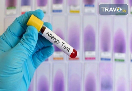 Комбиниран тест за алергии с изследване на 295 алергена в СМДЛ Кандиларов - Снимка 1