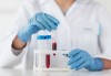 Кръвен тест за непоносимост към 24 храни и възможност за изследване за Candida Albicans IgG в Лаборатории Кандиларов в София, Варна, Шумен или Добрич! - thumb 2