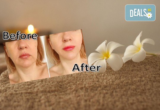 Терапия за един човек с 10 бр. колагенови мезоконци за моментален лифтинг ефект + RF лифтинг от Център Хелти Лайф, Пловдив - Снимка 2