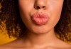 Красиви устни! Уголемяване на устни и запълване на бръчки с хиалуронов гел в Център Хелти Лайф, Пловдив - thumb 4