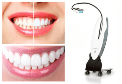 Сияйна усмивка: Избелване на зъби с DeaLux лампа + Pola Office система от Дентална клиника Фрисон - Снимка