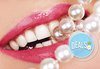 Почистване на зъбен камък, полиране и 2 фотополимерни пломби от Д-р Тихола Захариева - лекар по дентална медицина, Варна - thumb 3