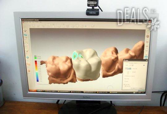 Обстоен преглед, почистване на зъбен камък и зъбна плака с ултразвук и AirFlow и полиране на зъби в център SBC dental! - Снимка 4