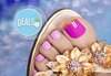 Разкрасете се! Подарете си педикюр с лакове LCN в цвят по избор и 2 декорации от салон Галакс, Плевен - thumb1 1