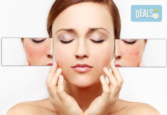 За кожа без несъвършенства! Лечебна терапия против акне с прополис в студио за красота Авангард! - Снимка 2