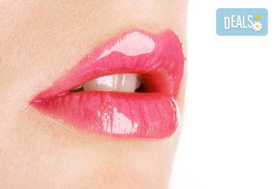 Подарете си филър за устни или попълване на бръчки с хиалуронова киселина: 0.5 мл или 1 мл! Бързо, безопасно и безболезнено! - Снимка 1