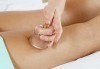 Оформете тялото си с антицелулитна терапия - вакумен масаж, RF и кавитация в салон Nails club в Младост 4! - thumb 1