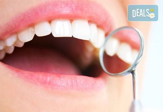 Почистване на зъбен камък и плака с ултразвук, полиране с Air Flow, бонус обстоен стоматологичен преглед от д-р Джорджев - Снимка 3