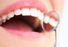 Почистване на зъбен камък и плака с ултразвук, полиране с Air Flow, бонус обстоен стоматологичен преглед от д-р Джорджев - thumb 3