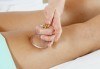 Стройна фигура! Антицелулитен масаж с вендузи, лимфен дренаж, третиране на кожата с антицелулитни масла от студио Be Happy! - thumb 1