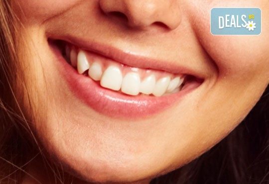 Шиниране на разклатен, парадонтозен зъб с трипластова фибро шина на швейцарската фирма Polydentia в Дентална клиника Персенк! - Снимка 1