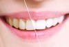 Професионално избелване на зъби с Pure Whitening System и почистване на зъбен камък, бонус от дентален кабинет д-р Шабанска! - thumb 1