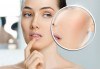 Мануално почистване на лице, дълбокопочистваща терапия, маска и крем за лице от студио за красота Relax Beauty! - thumb 1