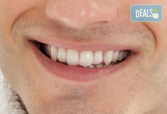 Грижа за красива усмивка! Обстоен стоматологичен преглед и почистване на зъбен камък, бонус от дентален кабинет д-р Шабанска! - Снимка 1