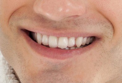Грижа за красива усмивка! Обстоен стоматологичен преглед и почистване на зъбен камък, бонус от дентален кабинет д-р Шабанска!