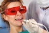 Почистване на зъбен камък с ултразвук, полиране и обстоен преглед, в клиника Рея Дентал! - thumb 2