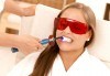 Професионално избелване на зъби с робот с LED лампа, обстоен преглед, почистване на зъбен камък и полиране, в клиника Рея Дентал! - thumb 2
