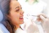 Професионално избелване на зъби с робот с LED лампа, обстоен преглед, почистване на зъбен камък и полиране, в клиника Рея Дентал! - thumb 3
