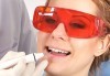 Професионално избелване на зъби с фотополимерна лампа, почистване на зъбен камък, полиране на зъбите, преглед и план на лечение от д-р Чорбаджаков, ж.к. Дружба - thumb 2