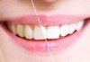 Професионално избелване на зъби с фотополимерна лампа, почистване на зъбен камък, полиране на зъбите, преглед и план на лечение от д-р Чорбаджаков, ж.к. Дружба - thumb 1