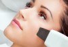 Ултразвукова шпатула за почистване на лице, нанотехнология за почистване и дезинкрустация от Веригата Дерматокозметични центрове Енигма! - thumb 1
