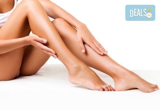 Покажете класа! IPL+RF фотоепилация за жени на зона по избор в салон за красота Beauty Angel! - Снимка 2