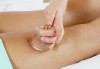 Красива фигура! Антицелулитен мануален масаж в комбинация с вендузи с висок клас немски масла KräuterhoF в Студио за красота SUNCHITA! - thumb 3