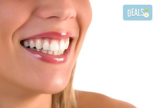 Почистване на зъбен камък и зъбна плака с ултразвук и полиране + бонус: 20 % отстъпка в ДК д-р Маринашева - Снимка 1
