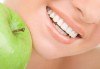 Професионално почистване на зъбен камък, полиране с AirFlow, стоматологичен преглед и цялостен план за лечение от Dental Studio Perfect - thumb 2