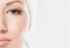 Заличете годините от лицето си! Иглена мезотерапия на околоочен контур за зряла кожа от Jewel Skin Clinic! - thumb 1