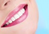 Професионално почистване на зъбен камък, полиране с AirFlow, стоматологичен преглед и цялостен план за лечение от Dental Studio Perfect - thumb 3