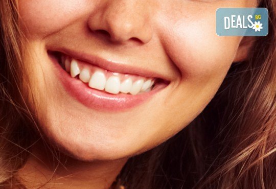 Обстоен преглед, план на лечение, почистване на зъбен камък, полиране с Air Flow и професионално избелване, от МР Дент - Снимка 1